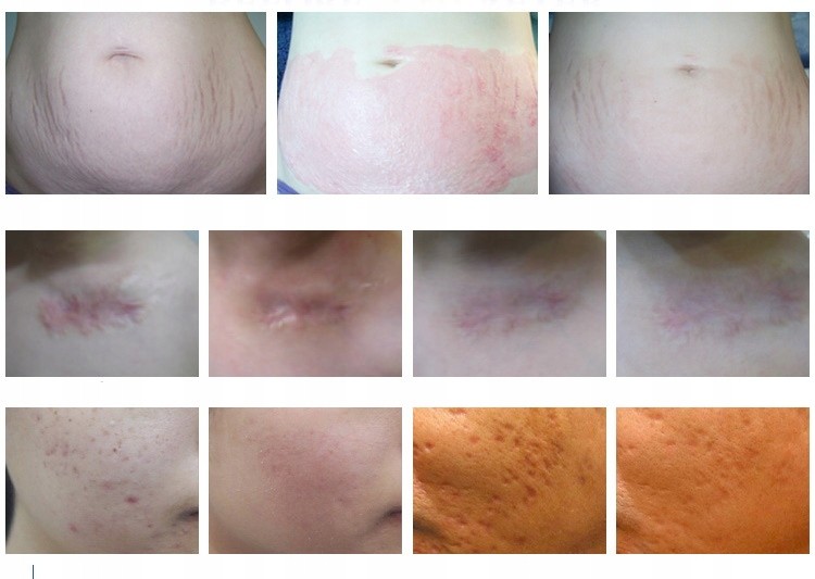 e877bf9f41dfaf0a83a479e655d9