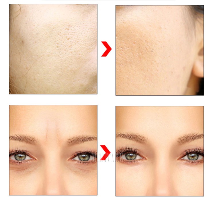 c8c964d64fd9bae4213bf868b951