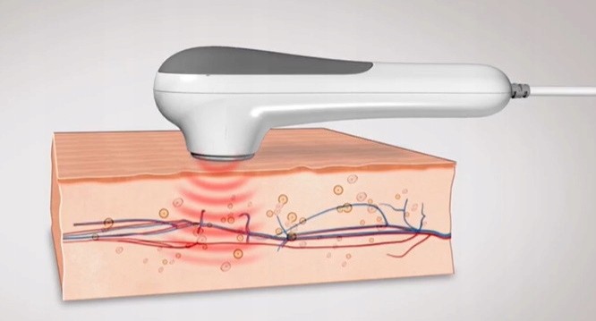 870221a842639b10dbbd66373f0e